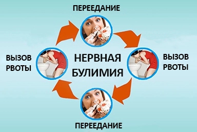 Лечение булимии в Козловке